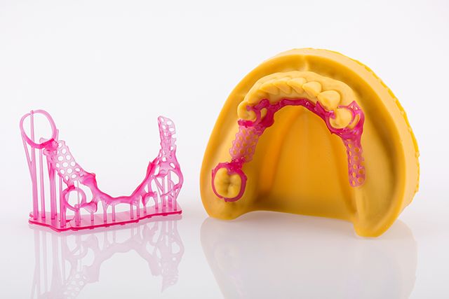3D打印在口腔齿科领域都这么卷了吗？