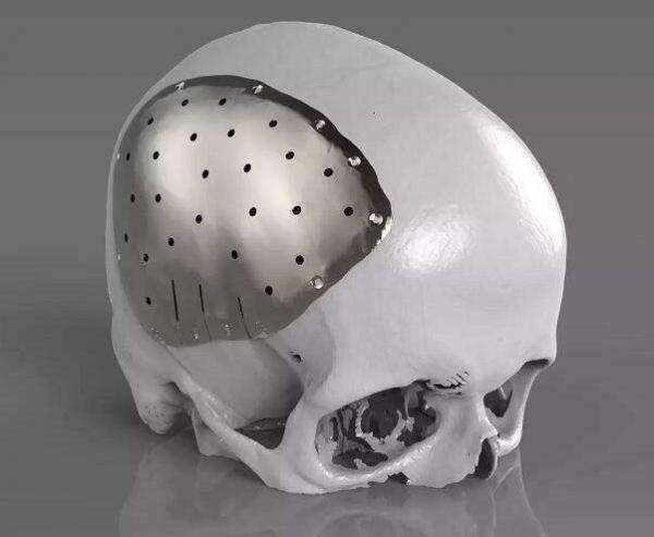 高精度金属3D打印技术