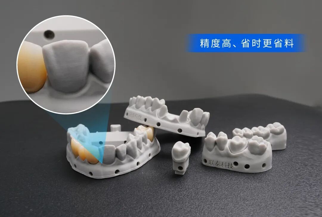 齿科3D打印